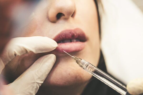 Wat is het verschil tussen botox en fillers?